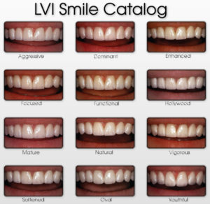 Types of Smiles What Type Of Smile Does Your Patient Desire