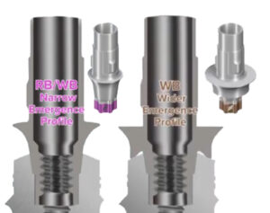 An Illustration showing RB & WB emergence dental implant types