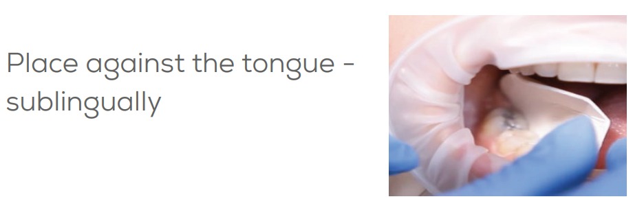 Sublingual Placement of a Dental Device