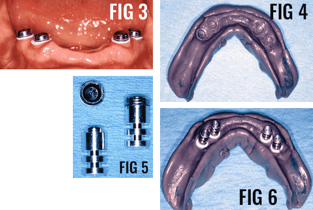 The different figures of mouth strap at Atlanta, GA The different figures of mouth strap at Atlanta, GA