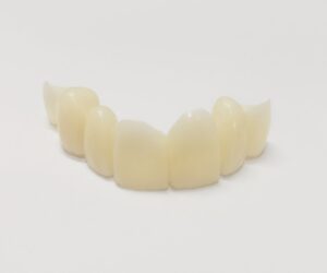 The fake teeth Model in Atlanta, GA A Dental Bridge, a Dental Prosthetic Used to Replace One or More Missing Teeth