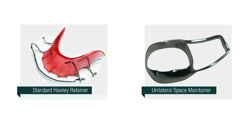 Standard Hawley and Unilateral space maintainer Standard Hawley and Unilateral space maintainer