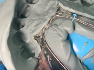 The image of poor mouth wash at Atlanta, GA The image of poor mouth wash at Atlanta, GA