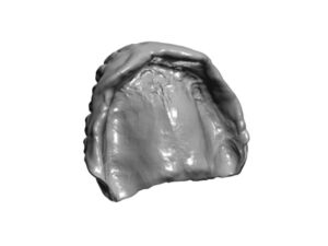3D digital scan of an existing upper denture showing the palatal surface